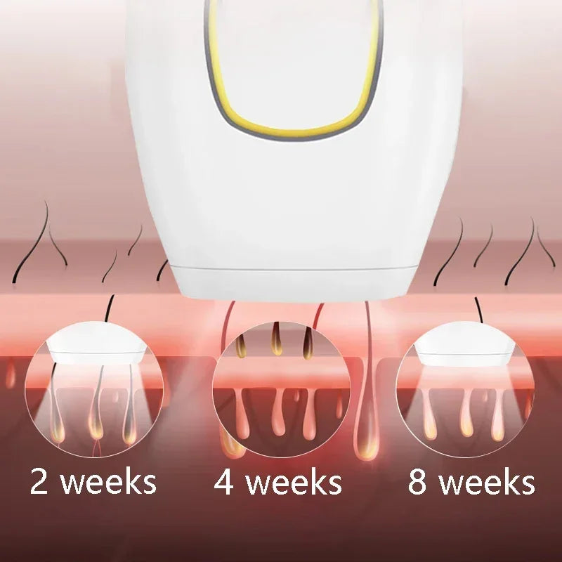 ZenSkin IPL