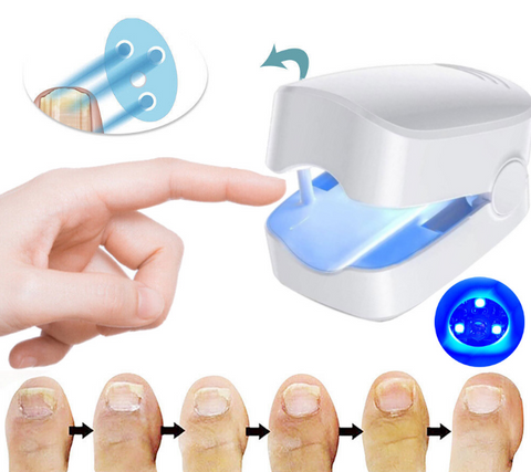 Nail Fungal Laser