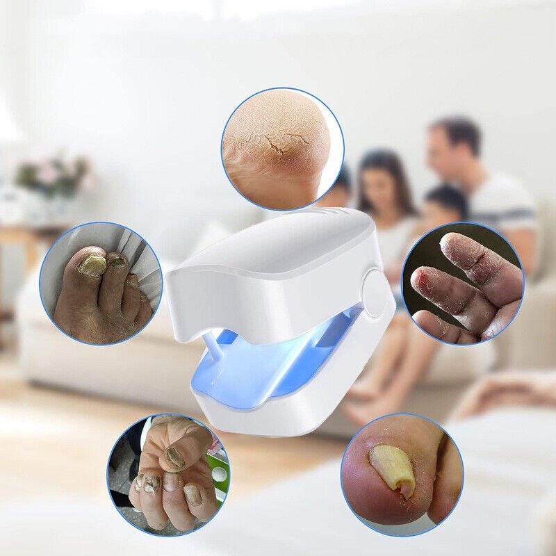 Nail Fungal Laser