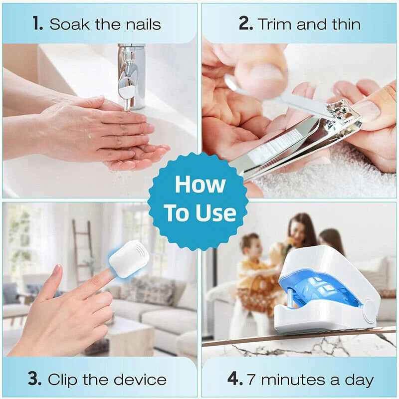 Nail Fungal Laser