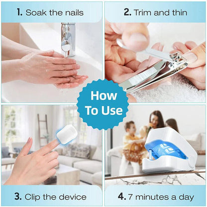 Nail Fungal Laser